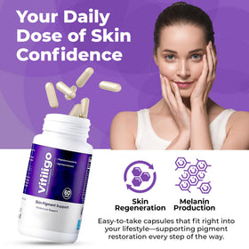 AURA VITAMINS Capsules Vitiligo 60 avec étiquette