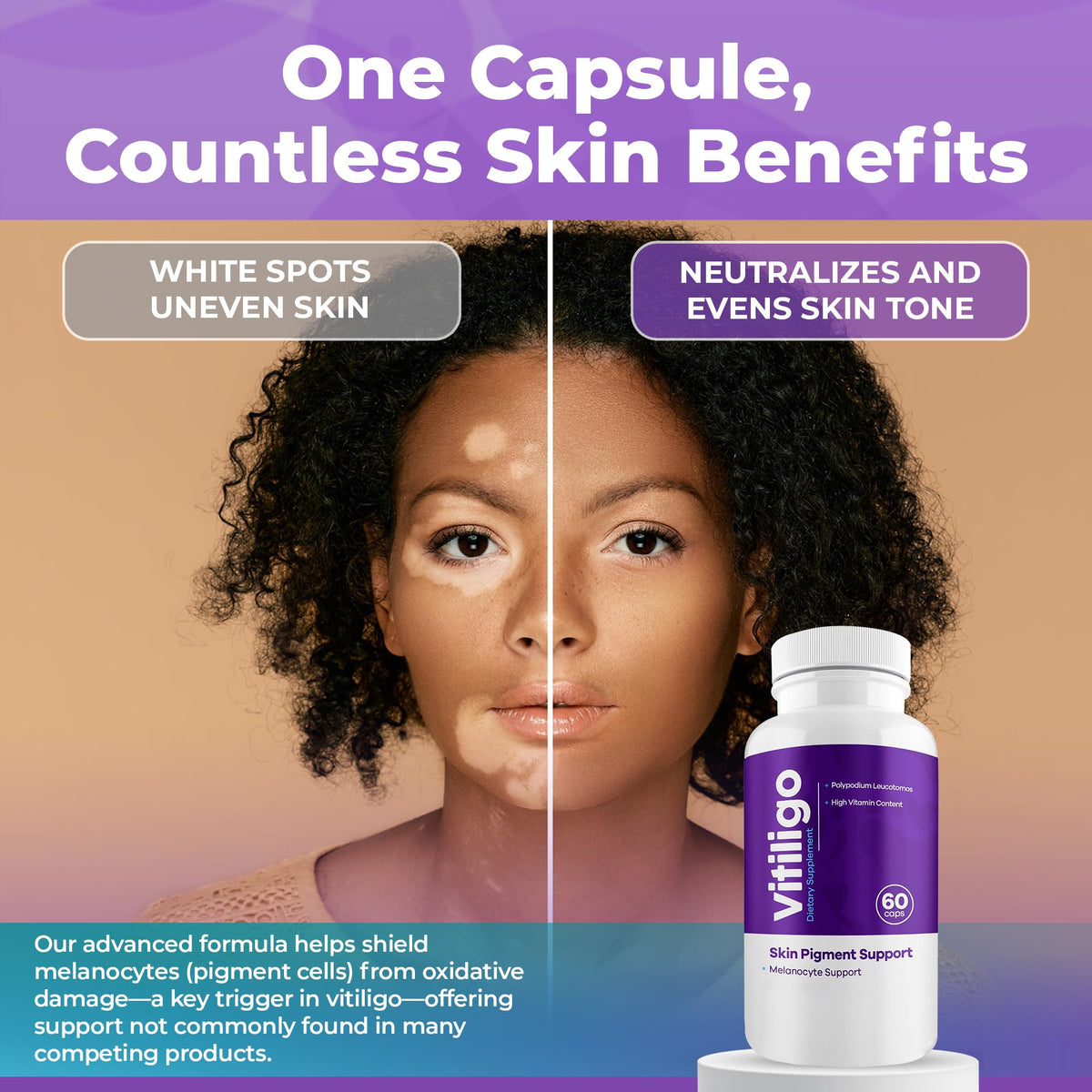 AURA VITAMINS Capsules Vitiligo en usage quotidien