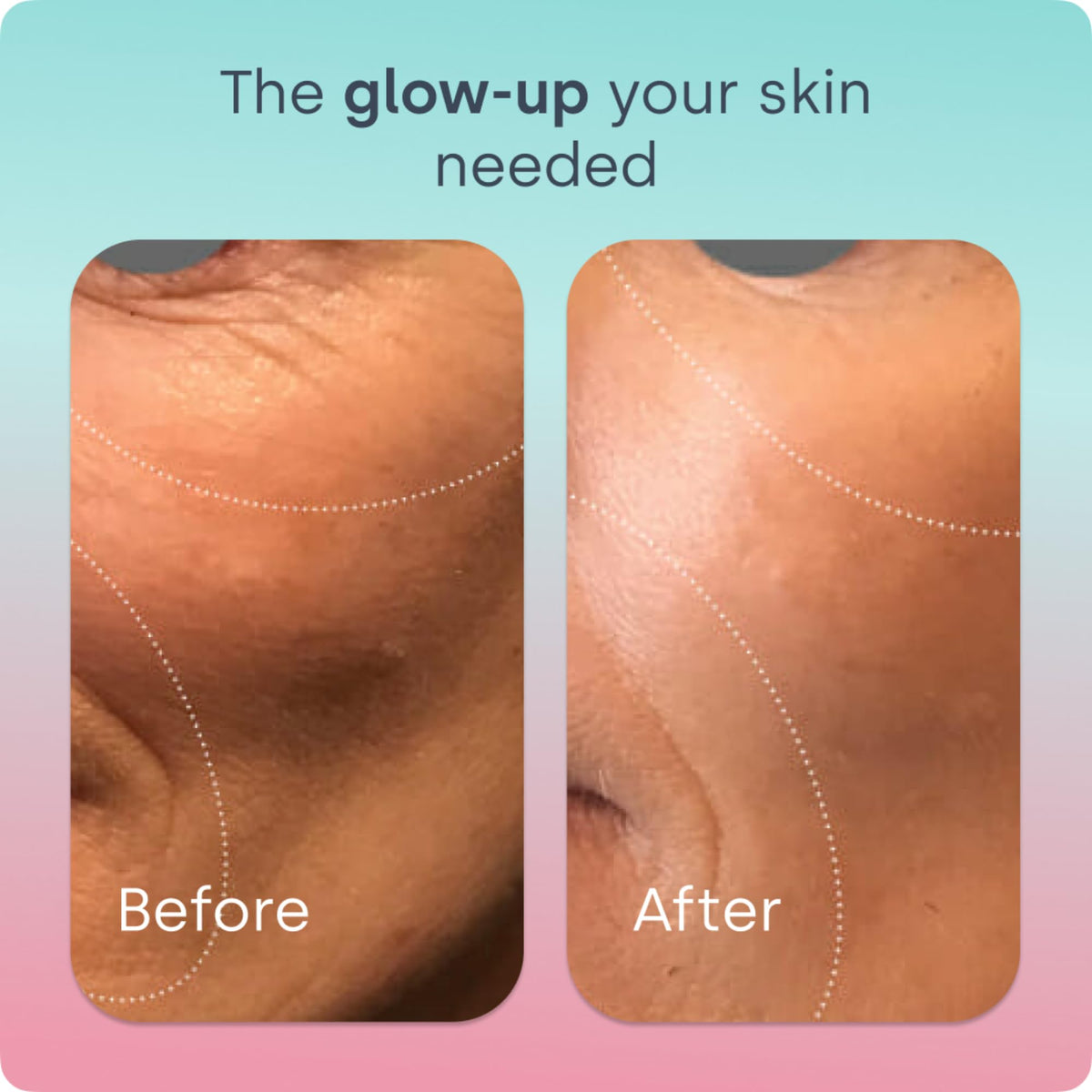Biosil Elixir Skin Renew 15 ml en vue latérale