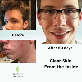 Capsules de vitamines Innate Skin pour peau claire, vue de près