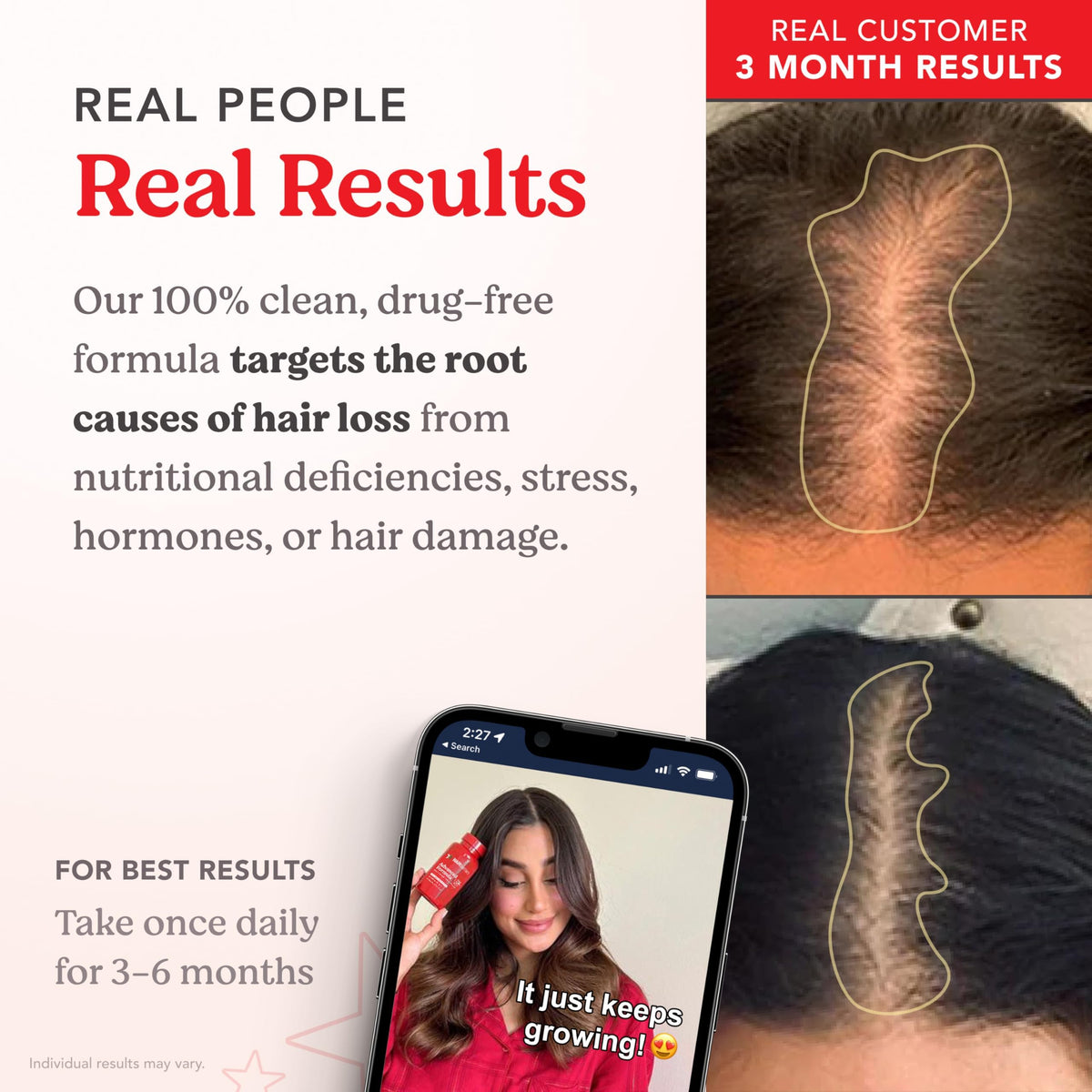 Capsules HAIRtamin dans une main