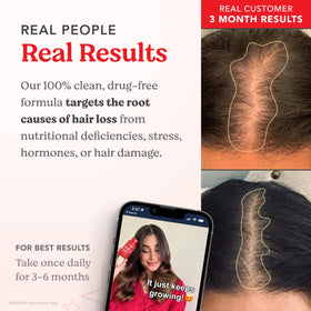 Capsules HAIRtamin dans une main