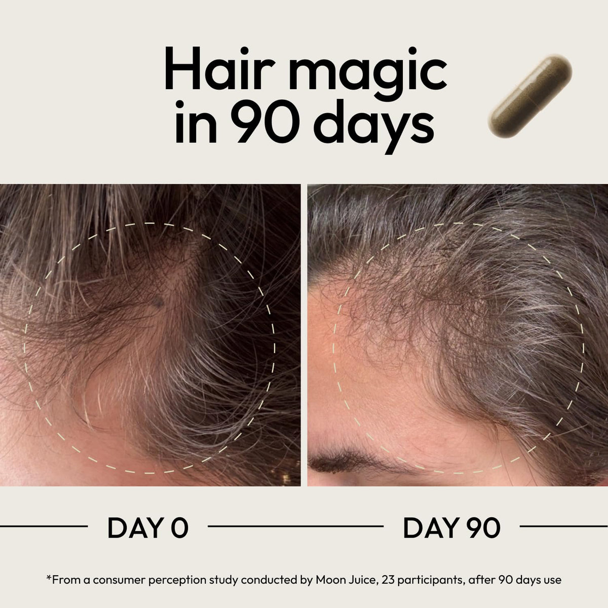 Composition des vitamines SuperHair sur l'étiquette