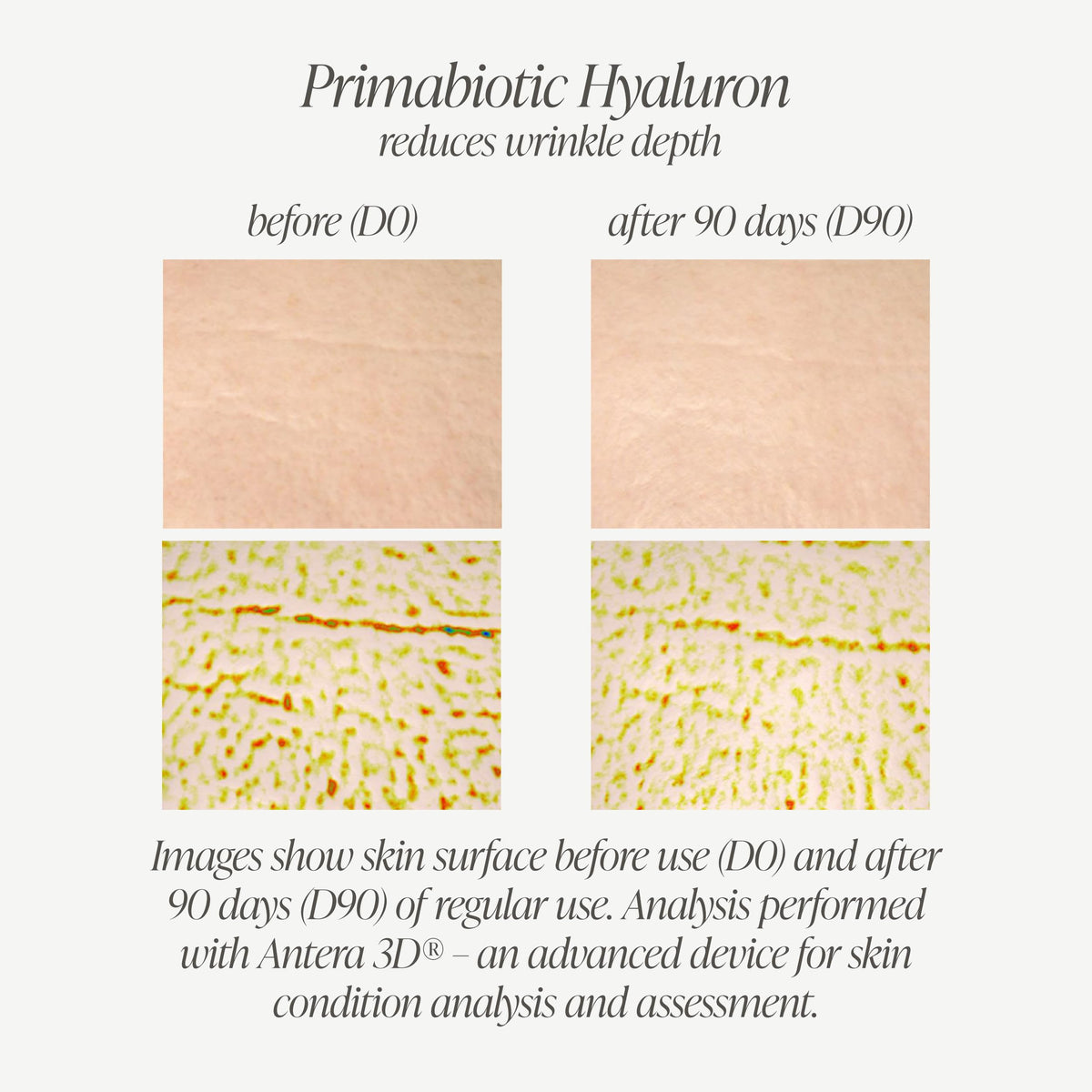 Détail de l'étiquette de PRIMABIOTIC Acide Hyaluronique 250mg