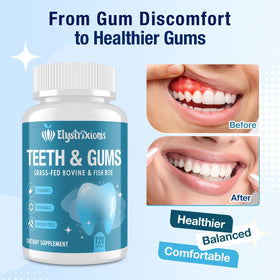 Elystrixionis Gum Restore sur un fond de marbre élégant