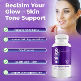 Emballage des Capsules Vitiligo AURA VITAMINS