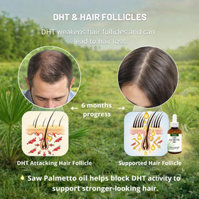Flacon d'huile de Saw Palmetto PHYTO LIFE sur une table en bois