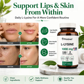 Flacon de L-Lysine PRISTINE'S avec capsules à côté