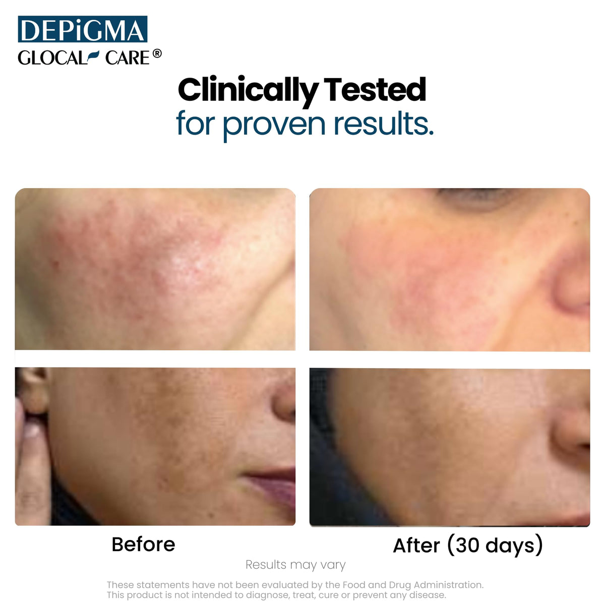 Gclose-up des capsules GlocalCare Depigma