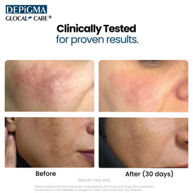 Gclose-up des capsules GlocalCare Depigma