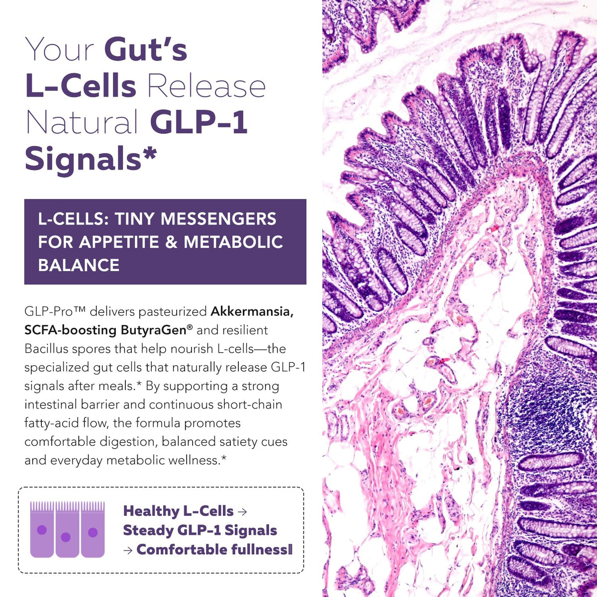 GLP-Pro™ Triquetra Health gélules sur une surface neutre