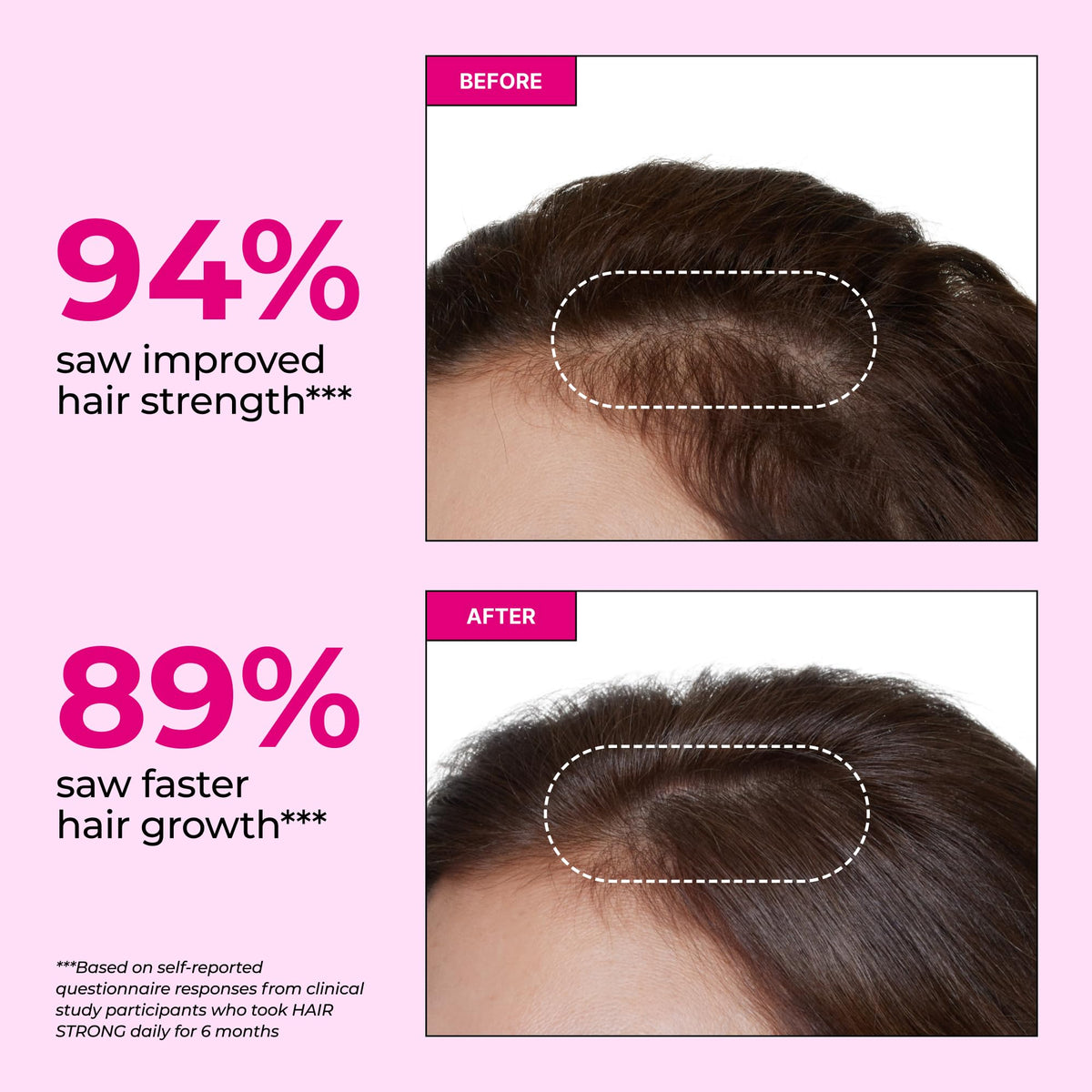Gummies Cheveux Forts HUM avec biotine et zinc sur fond blanc