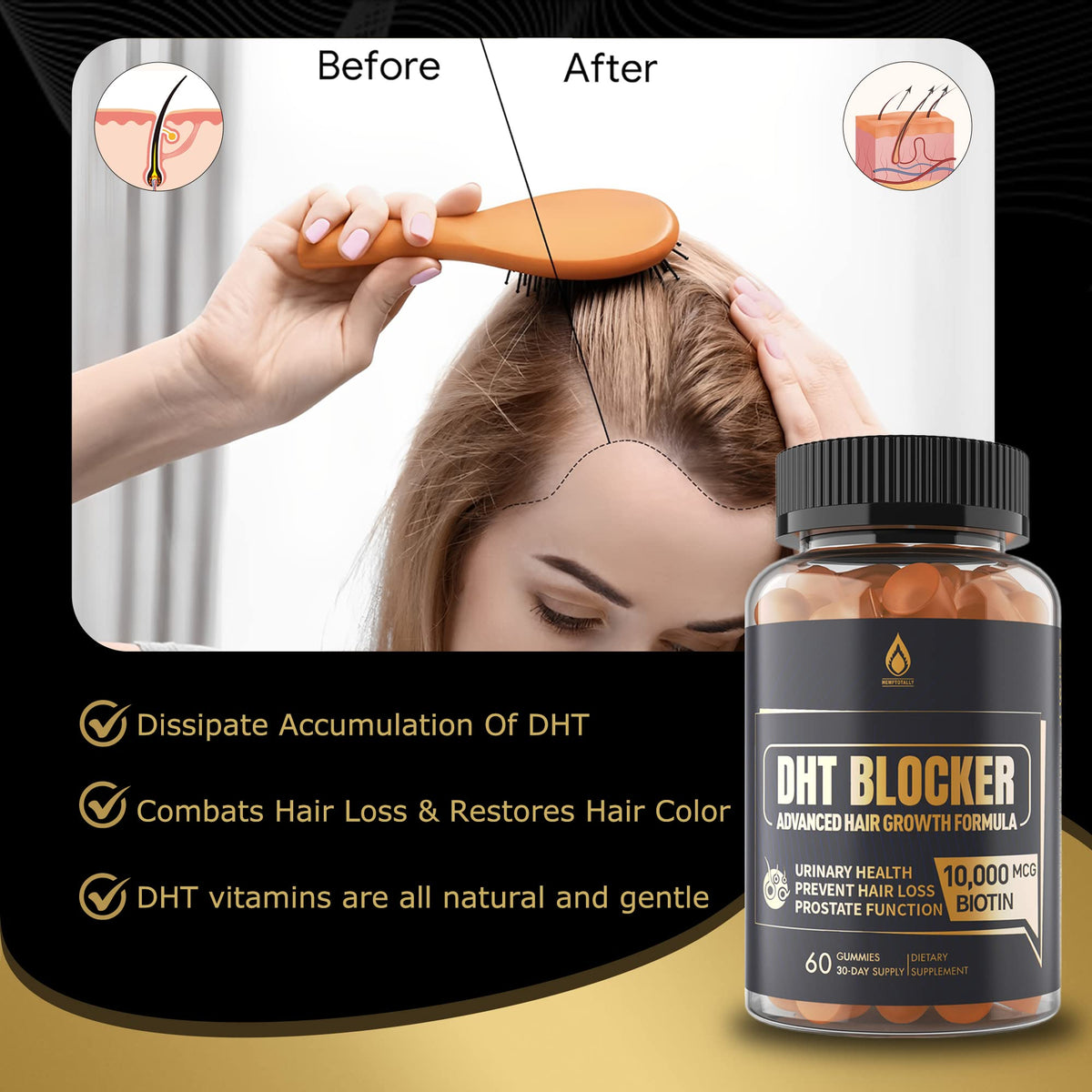 Gummies DHT Blocker EnvyDeal ouvertes avec une poignée de gummies