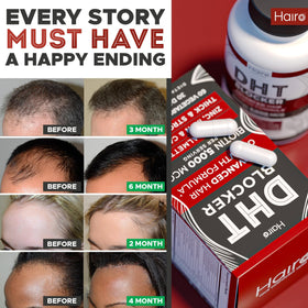 Hairo Nutrition gélules sur fond blanc avec ombre