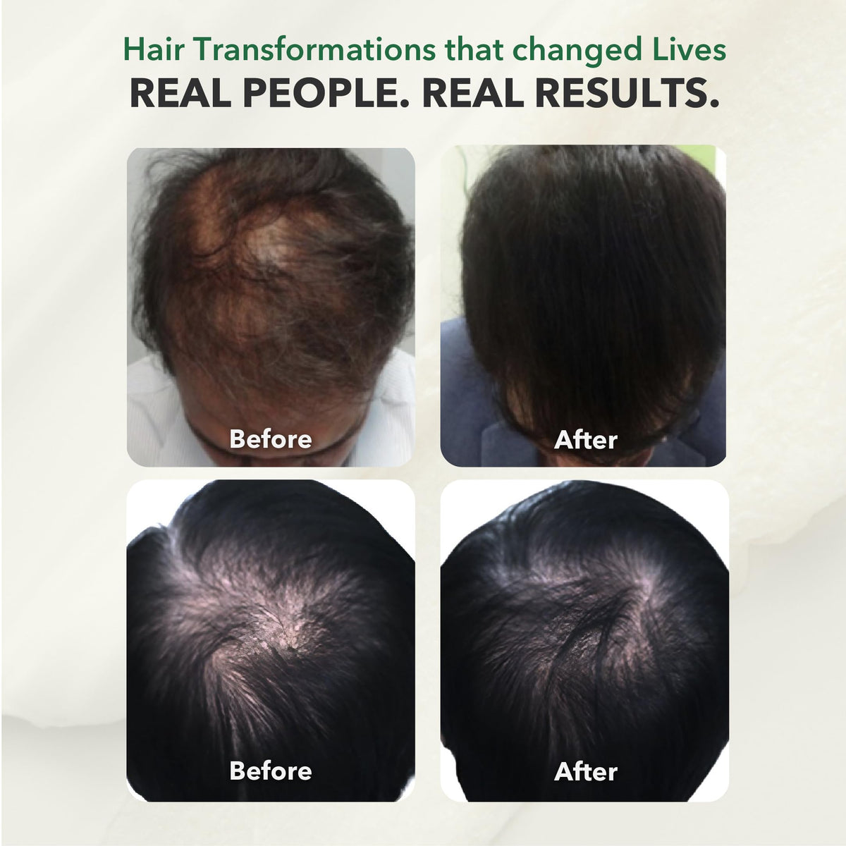HairSmart DHT Blocker capsules avec des plantes