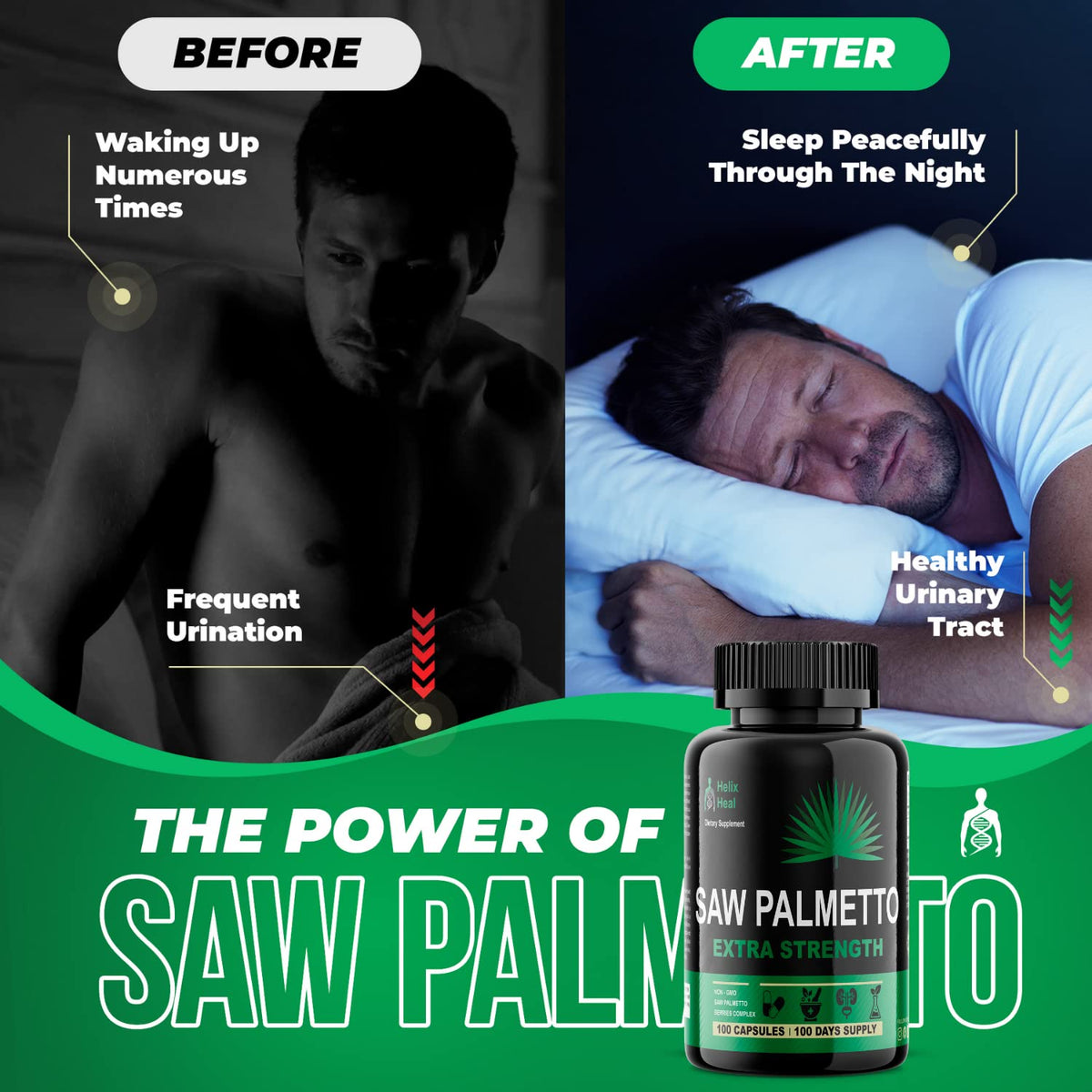 Helix Heal Saw Palmetto pour Hommes avec une mesure de gélules