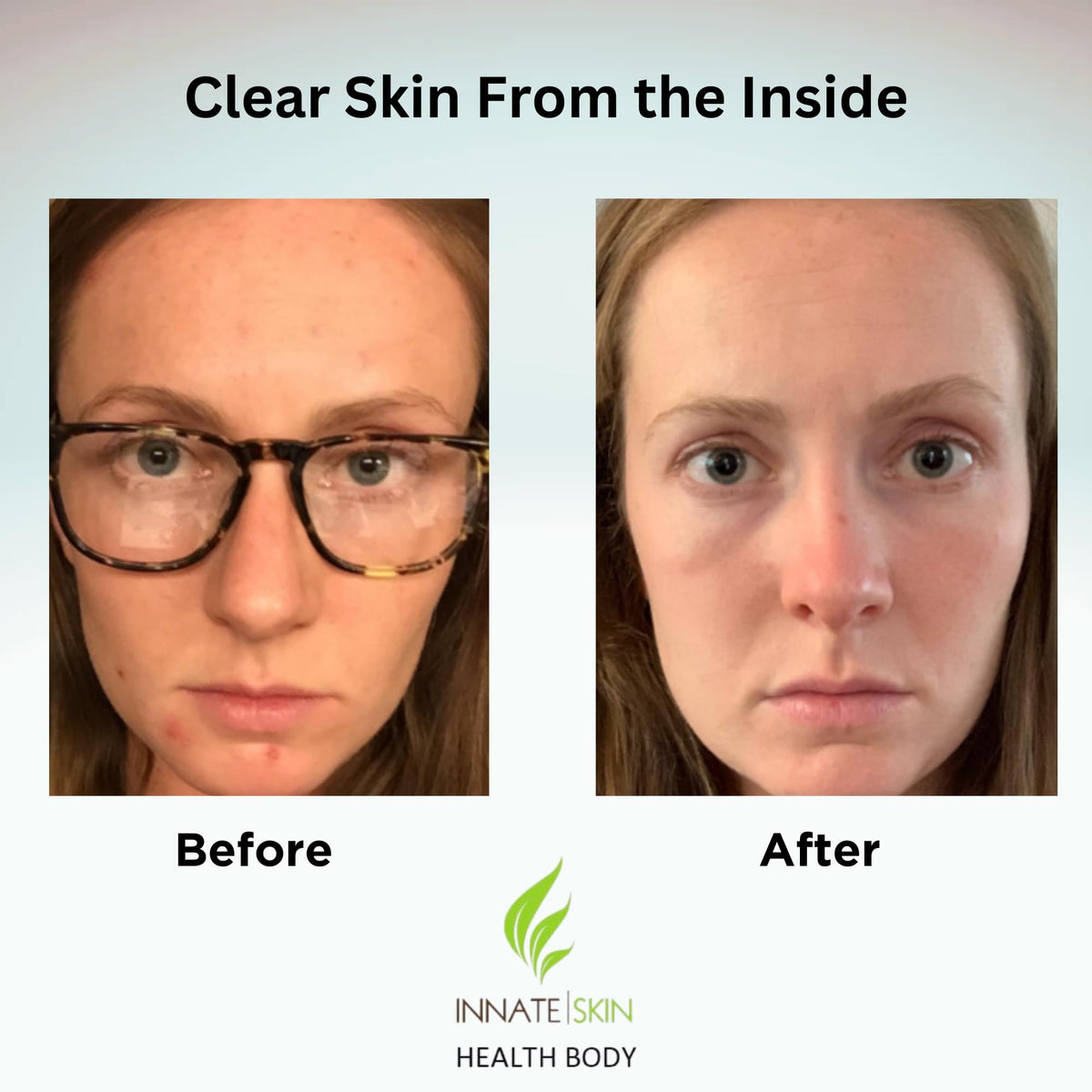 Ingrédients naturels du système de vitamines Innate Skin
