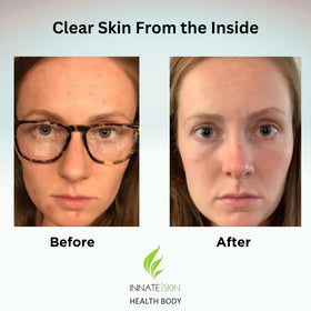 Ingrédients naturels du système de vitamines Innate Skin
