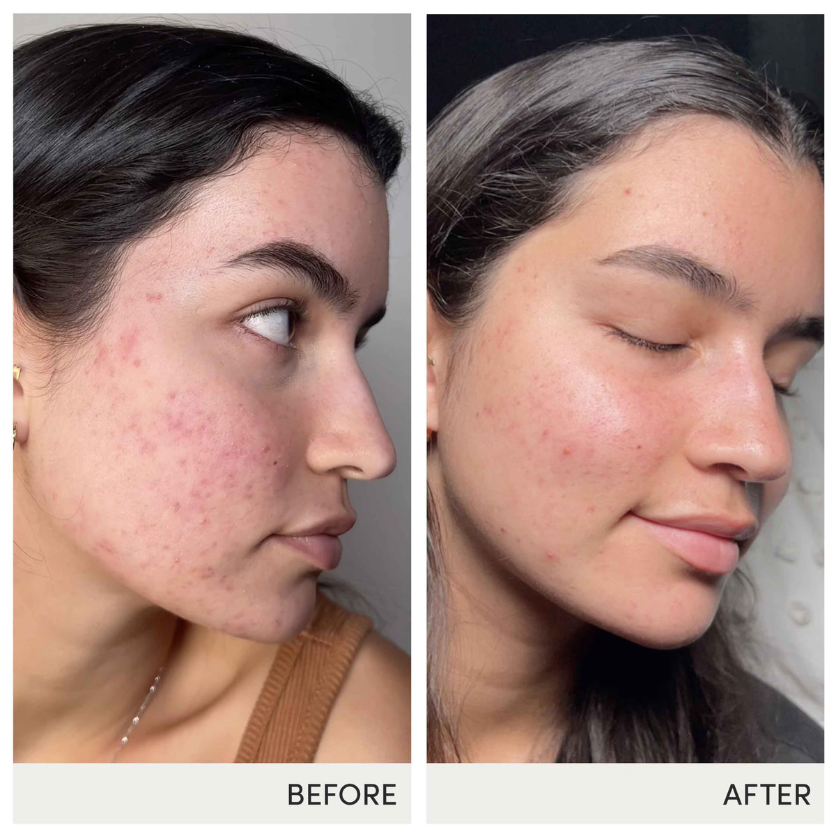 jane iredale Skin Accumax gélules avec une tasse d'eau