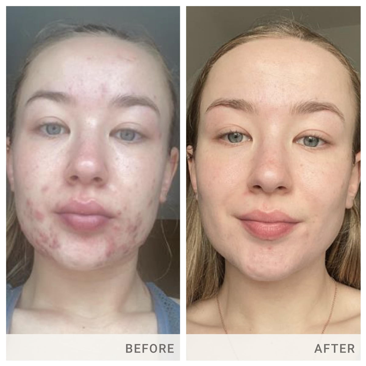 jane iredale Skin Accumax supplément sur une table