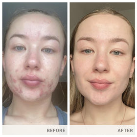jane iredale Skin Accumax supplément sur une table