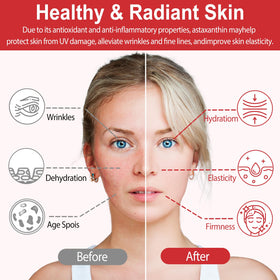 Linizanjiiy Astaxanthin 12mg gélules douces sur table