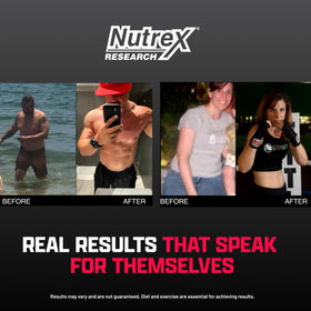 Nutrex Research Lipo-6 Black Ultra Concentrate boîte avec gélules
