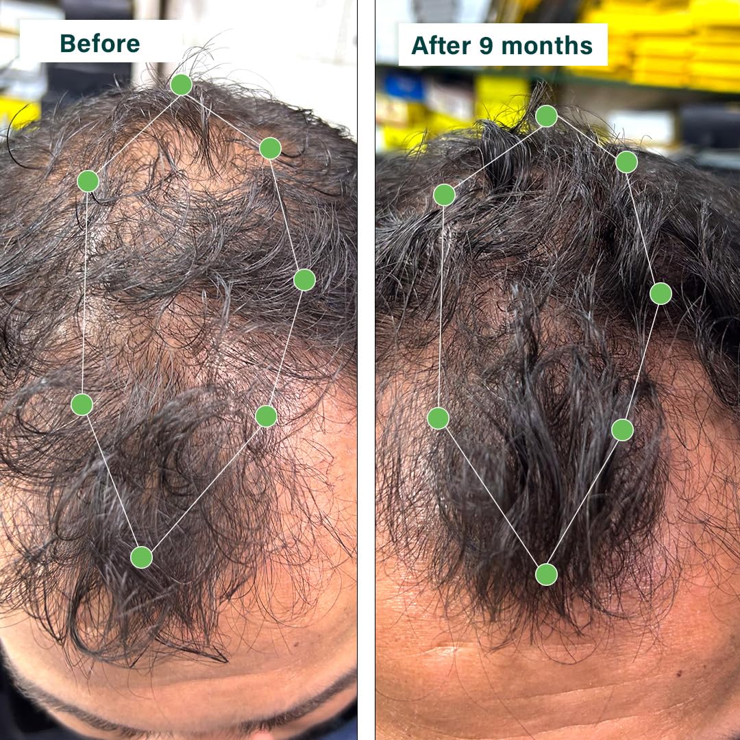 OZIVA Cheveux Végétaux capsules avec un verre d'eau