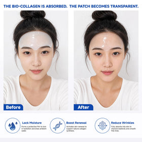 Patches TrySafe Anti-Rides Forehead, texture du produit