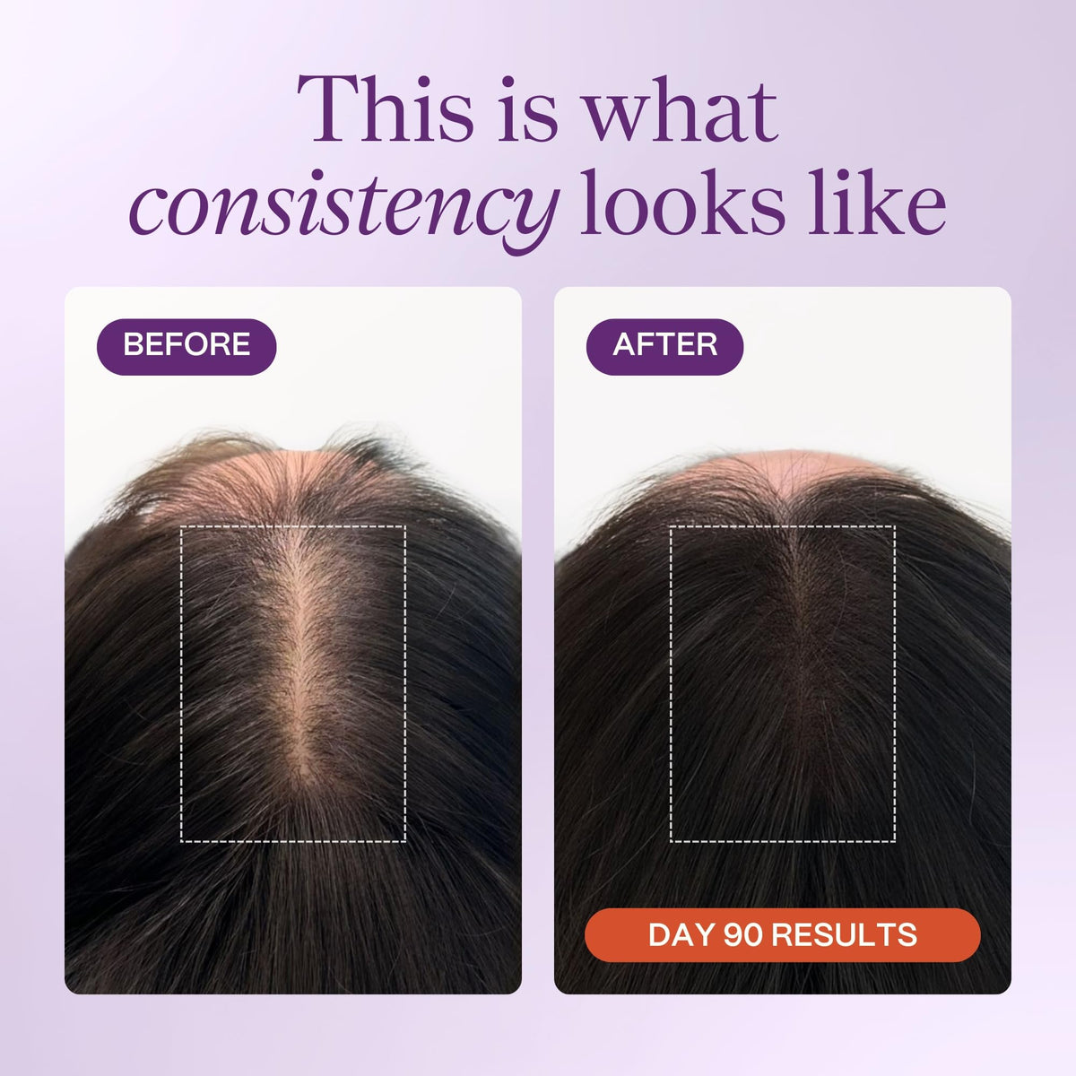Rejuveen KeraLush Vitamines pour Cheveux - utilisation quotidienne
