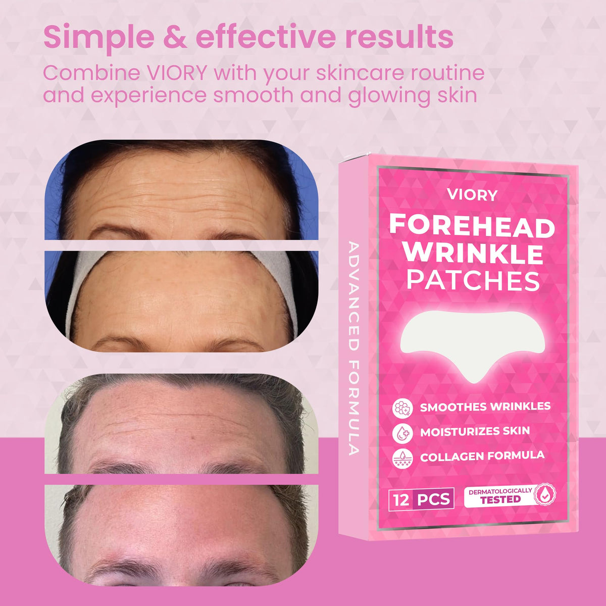 VIORY Patches Anti-Rides Frontaux - Application sur le front