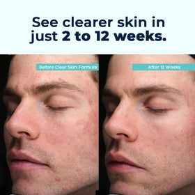 VitaMedica Clear Skin Vitamin Formula 60 Ct côté